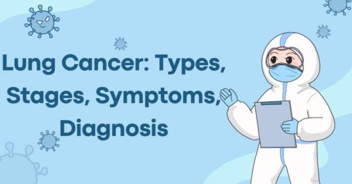 Lung Cancer: Types, Stages, Symptoms, Diagnosis